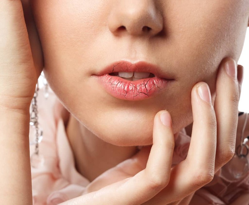 Bệnh Giảm Tiết Nước Bọt: Nguyên Nhân, Triệu Chứng Và Cách Điều Trị Hiệu Quả 14 nb3