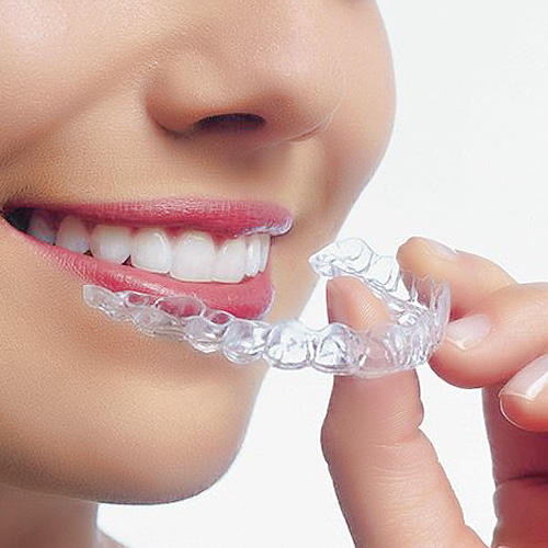 Máng chống nghiến răng