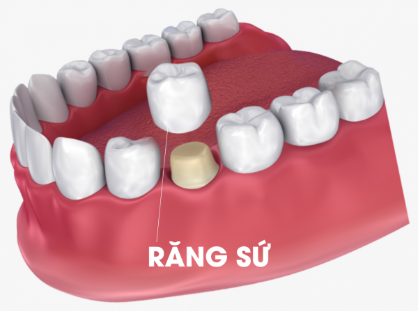 nut rang 4