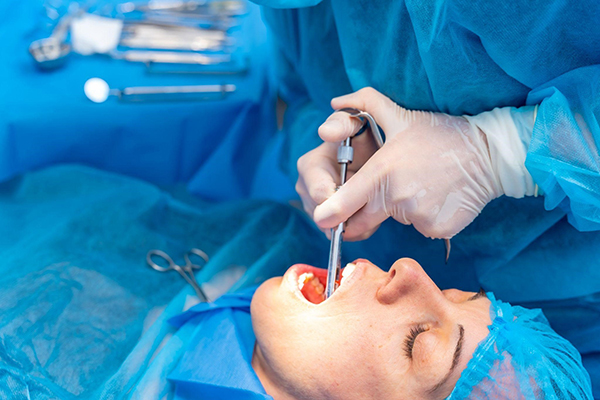 Viêm Nha Chu Mạn Tính: Tổng Quan, Cơ Chế Bệnh Sinh, Phương Pháp Chẩn Đoán Và Điều Trị 13 phau thuat rang khon giam thieu sang chan 1