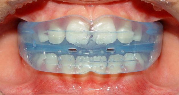 rml4
