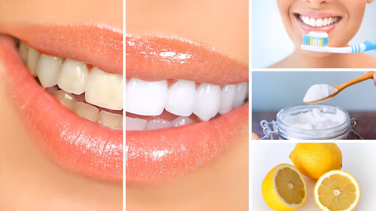 Răng Bị Đổi Màu: Nguyên Nhân, Triệu Chứng và Phương Pháp Điều Trị 14 rov4