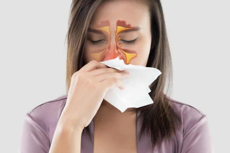 Biểu hiện của viêm xoang