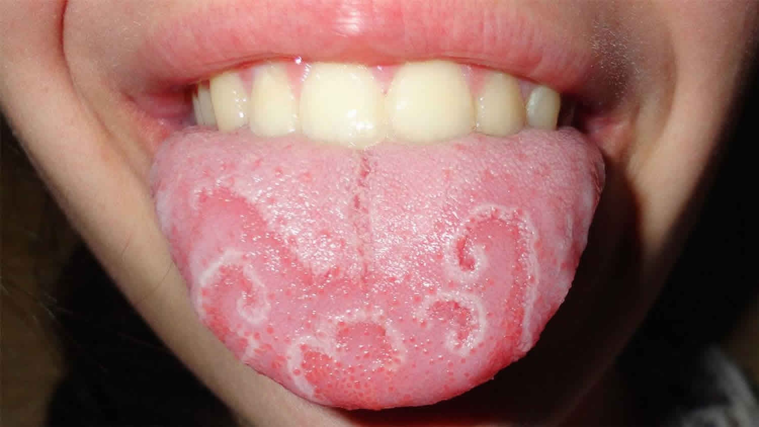 vl3