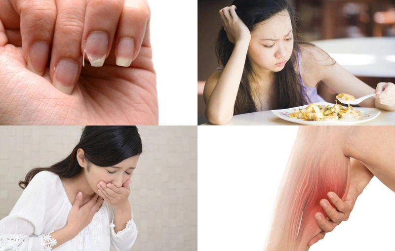 Bệnh Do Thiếu Hụt Vitamin: Nguyên Nhân, Triệu Chứng Và Cách Điều Trị 9 Các triệu chứng của thiếu hụt vitamin