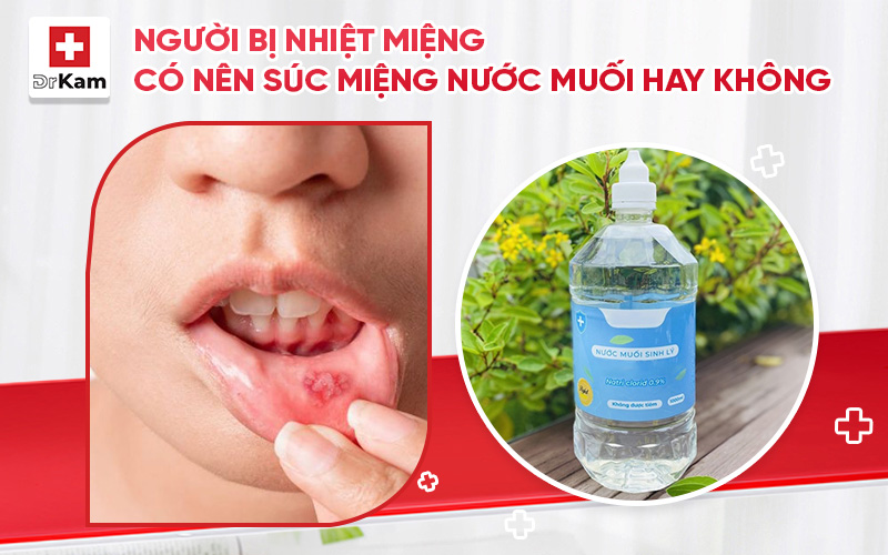 bị nhiệt miệng có nên súc miệng nước muối
