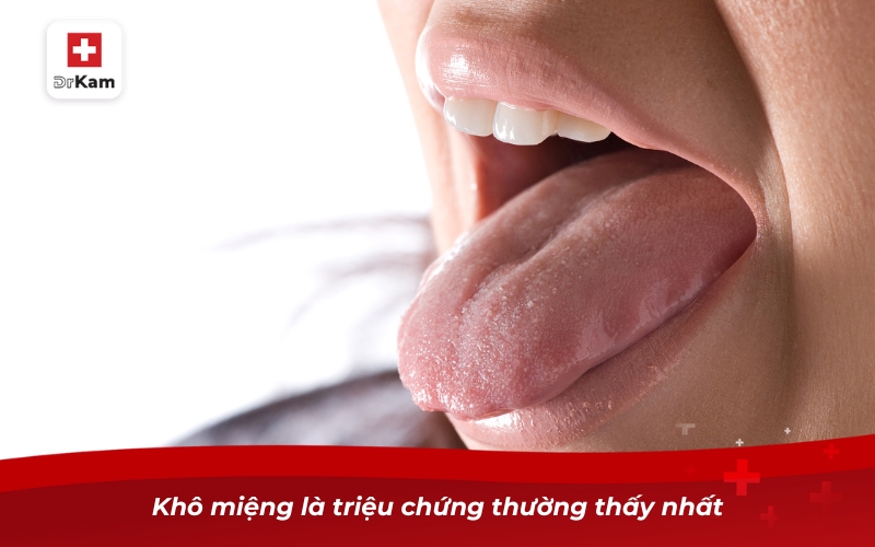 Khô miệng là triệu chứng thường thấy nhất