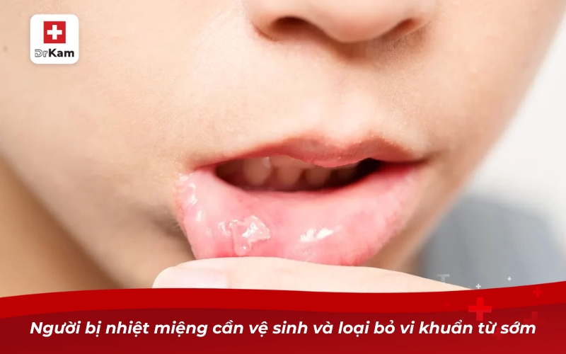 Top 10 nước súc miệng hỗ trợ trị nhiệt miệng tốt nhất 9 Người bị nhiệt miệng cần vệ sinh và loại bỏ vi khuẩn từ sớm