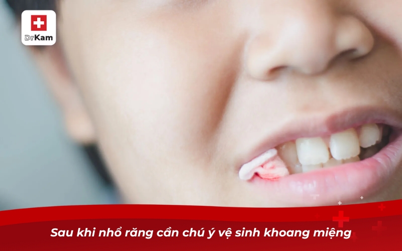 Khám phá Top 10 nước súc miệng sau nhổ răng hỗ trợ hồi phục 10 Sau khi nhổ răng cần chú ý vệ sinh khoang miệng