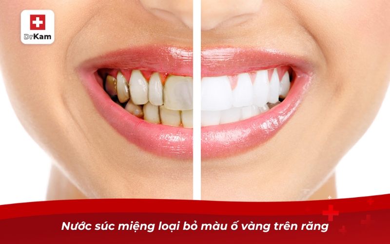 Top 8 nước súc miệng trắng răng hiệu quả hiện nay 6 Nước súc miệng trắng răng có hiệu quả không?