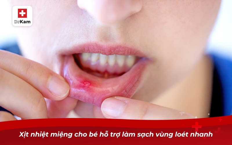 Xịt nhiệt miệng cho bé - Giải pháp hiệu quả và an toàn 8 Xịt nhiệt miệng cho bé hỗ trợ làm sạch vùng loét nhanh