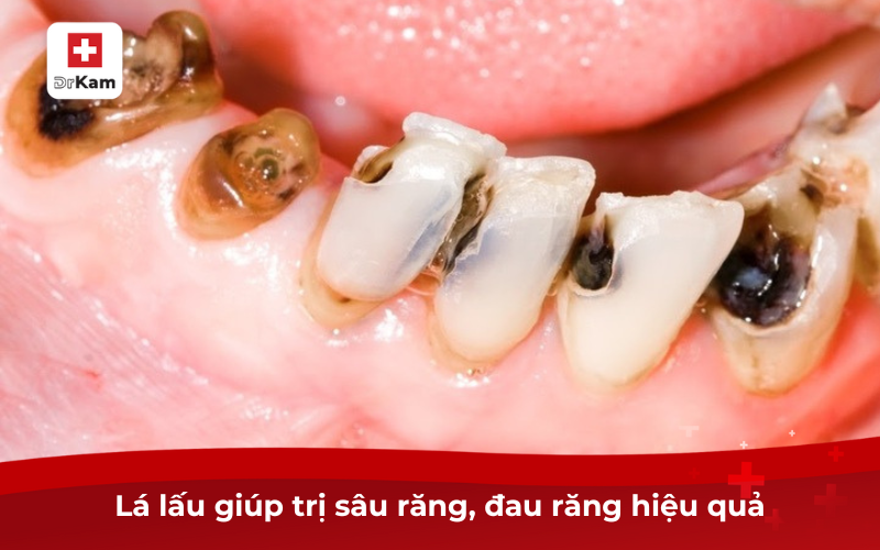 Lá lấu có tác dụng gì? Cách dùng lá lấu chữa sâu răng hiệu quả 8 Dùng lá lấu chữa sâu răng tại nhà