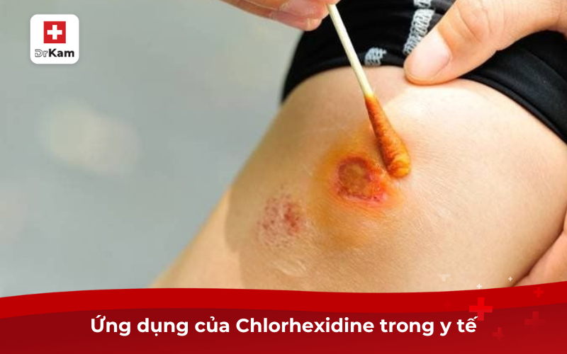 Chlorhexidine là gì? Tác dụng và những lưu ý khi sử dụng 7 Ứng dụng của Chlorhexidine trong y tế