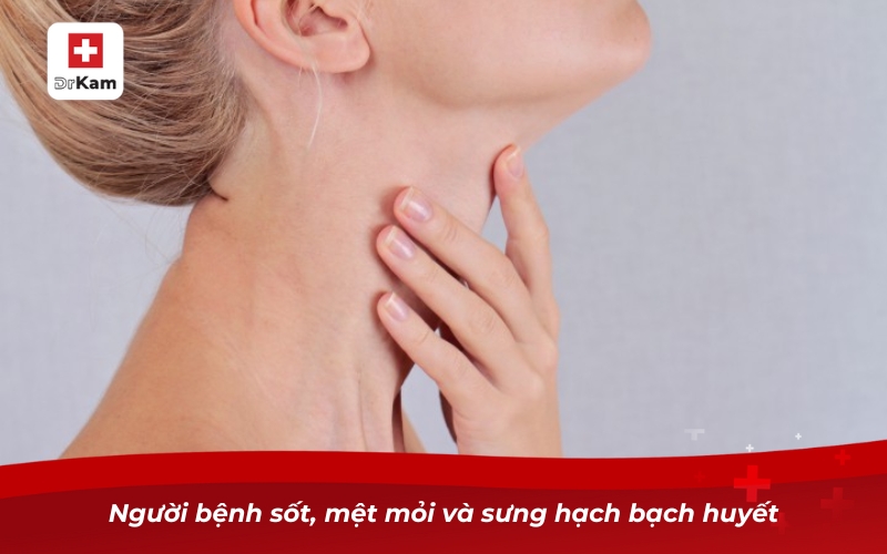 Các loại viêm họng - Phân loại triệu chứng và điều trị 18 Người bệnh sốt, mệt mỏi và sưng hạch bạch huyết