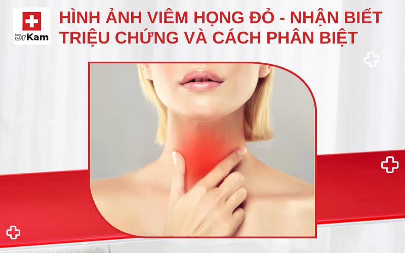 hinh anh viem hong do thumbnail