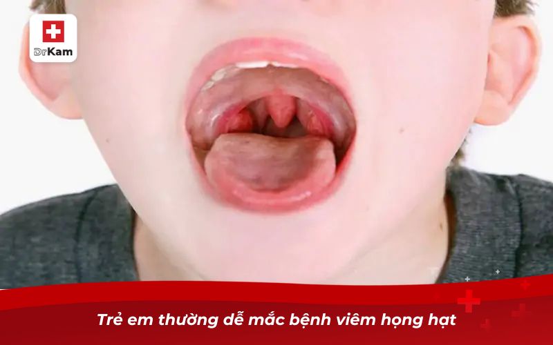 Hình ảnh viêm họng hạt ở trẻ em và cách nhận biết bé bị viêm họng 10 Trẻ em thường dễ mắc bệnh viêm họng hạt