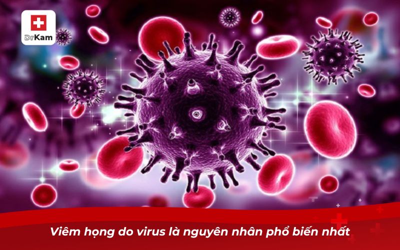Nguyên nhân gây viêm họng và cách phòng ngừa hiệu quả 8 Viêm họng do virus là nguyên nhân phổ biến nhất