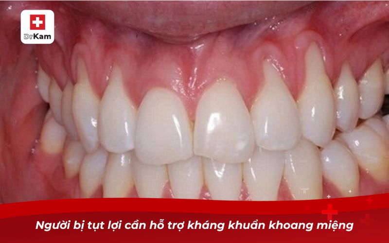 Nước súc miệng chữa tụt lợi giúp phục hồi nướu hiệu quả 9 Người bị tụt lợi cần hỗ trợ kháng khuẩn khoang miệng