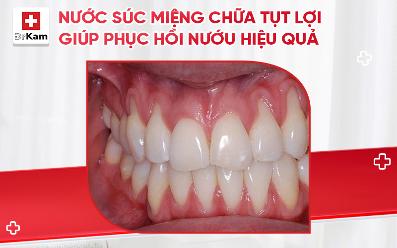 nuoc suc mieng chua tut loi thumbnail