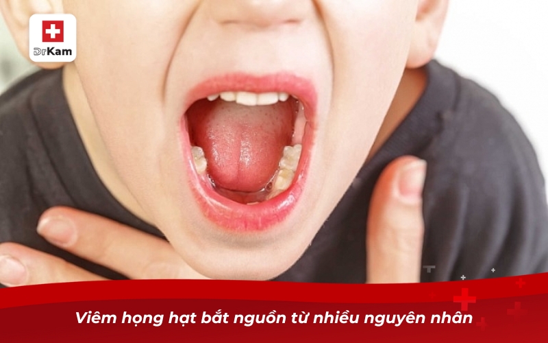 Viêm họng hạt bắt nguồn từ nhiều nguyên nhân