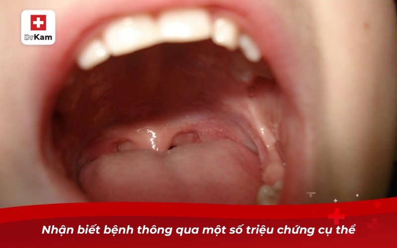 Nhận biết bệnh thông qua một số triệu chứng cụ thể