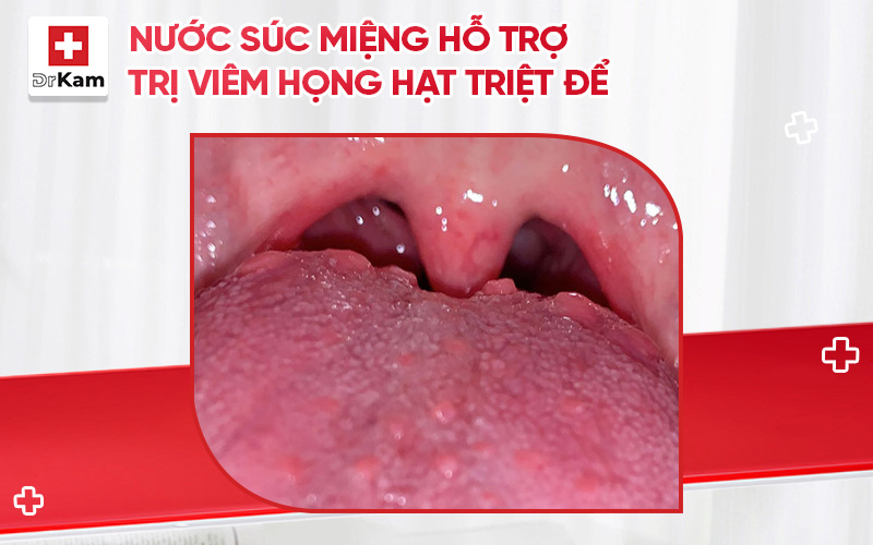 nuoc suc mieng ho tro viem hong hat thumbnail