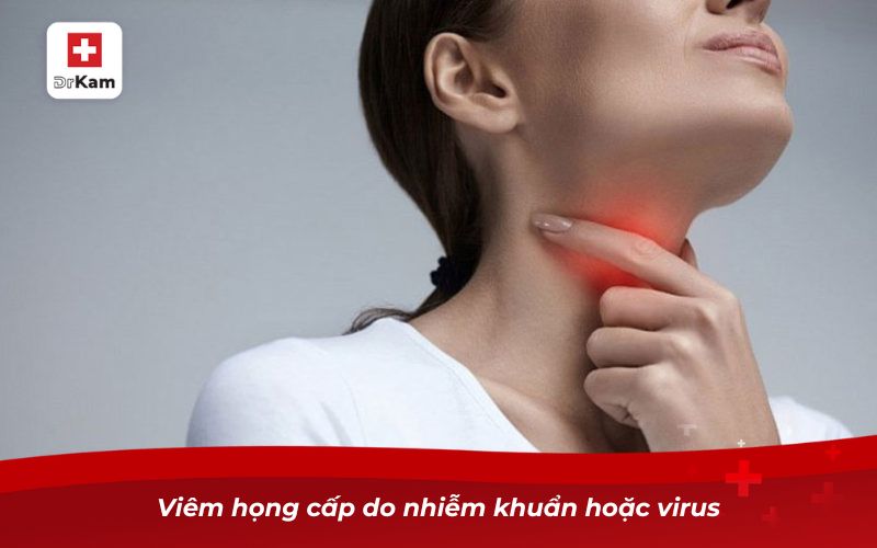 Xác Định Triệu Chứng Viêm Họng Cấp Ở Người Lớn 8 Viêm họng cấp do nhiễm khuẩn hoặc virus
