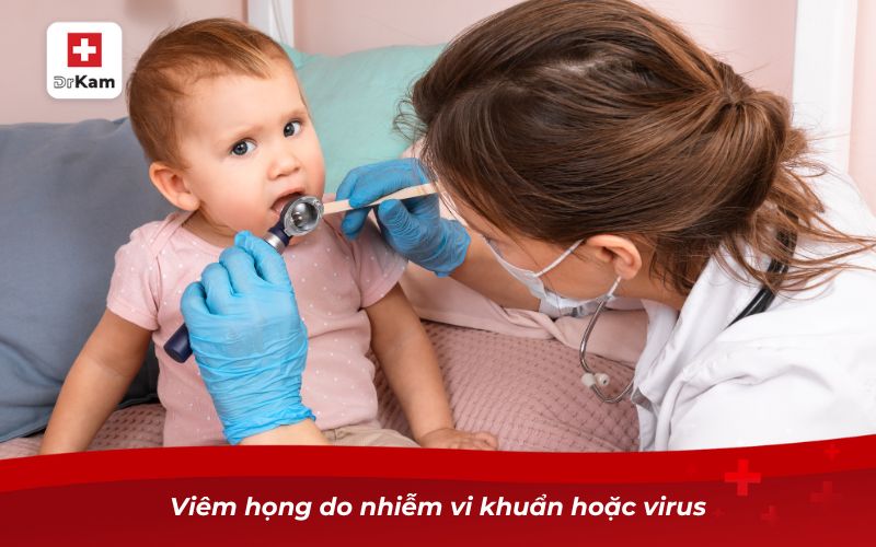 Những điều cần biết về viêm họng cấp ở trẻ em 9 Viêm họng do nhiễm vi khuẩn hoặc virus