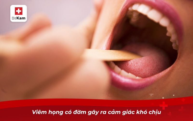 Viêm họng có đờm: Nguyên nhân, biến chứng và cách điều trị 8 Viêm họng có đờm gây ra cảm giác khó chịu