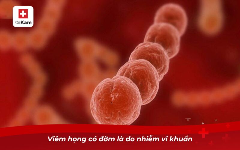 Viêm họng có đờm: Nguyên nhân, biến chứng và cách điều trị 9 Viêm họng có đờm là do nhiễm vi khuẩn