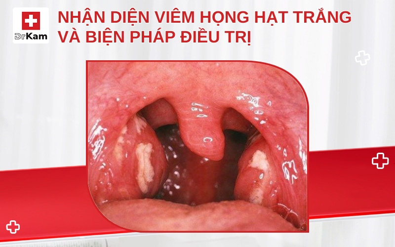 viem hong hat trang thumbnail