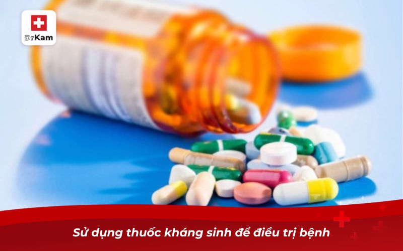 Viêm họng liên cầu ở trẻ em: Dấu hiệu, nguyên nhân và cách điều trị 12 Sử dụng thuốc kháng sinh để điều trị bệnh