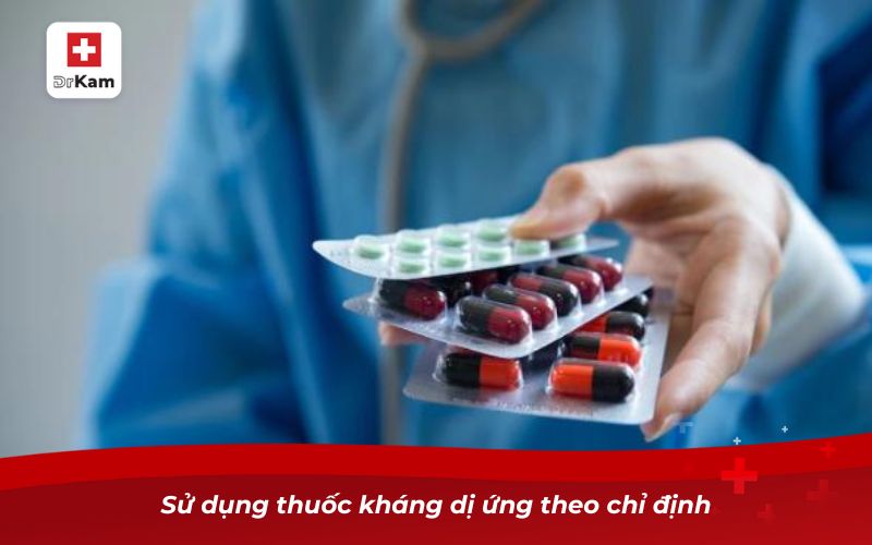 Các loại viêm họng: Nguyên nhân, triệu chứng và cách điều trị 27 Sử dụng thuốc kháng dị ứng theo chỉ định