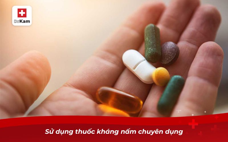 Các loại viêm họng: Nguyên nhân, triệu chứng và cách điều trị 29 Sử dụng thuốc kháng nấm chuyên dụng