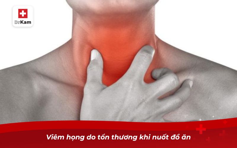 Các loại viêm họng: Nguyên nhân, triệu chứng và cách điều trị 30 Viêm họng do tổn thương khi nuốt đồ ăn
