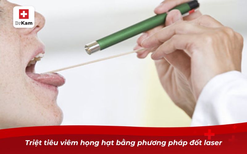 Các loại viêm họng: Nguyên nhân, triệu chứng và cách điều trị 22 Triệt tiêu viêm họng hạt bằng phương pháp đốt laser