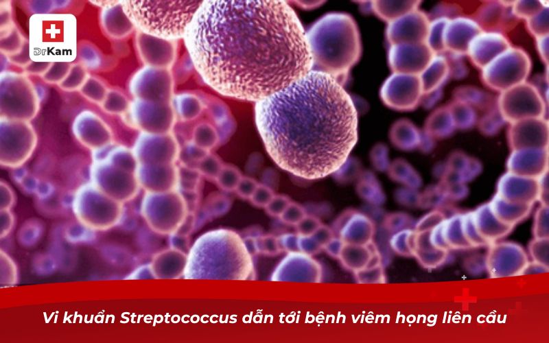Các loại viêm họng: Nguyên nhân, triệu chứng và cách điều trị 23 Vi khuẩn Streptococcus dẫn tới bệnh viêm họng liên cầu