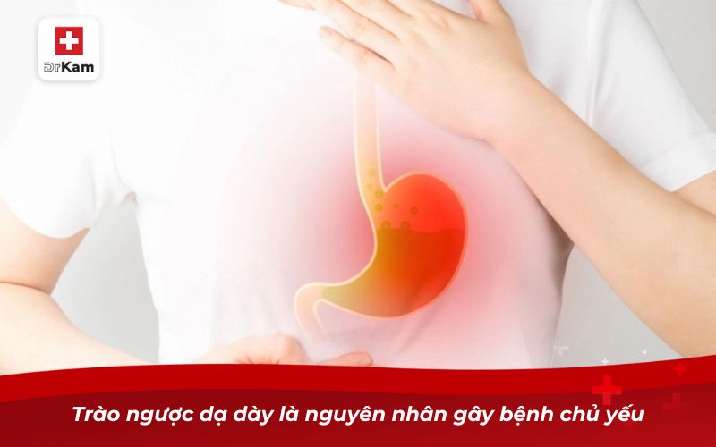 Các loại viêm họng: Nguyên nhân, triệu chứng và cách điều trị 25 Trào ngược dạ dày là nguyên nhân gây bệnh chủ yếu