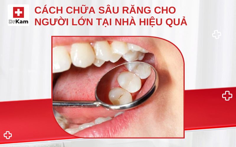 cach chua sau rang cho nguoi lon thumbnail