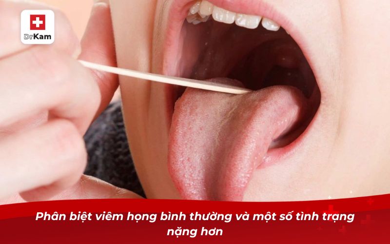 Cách nhận biết chính xác hình ảnh bị viêm họng bình thường 9 Phân biệt viêm họng bình thường và một số tình trạng nặng hơn