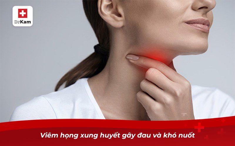 Nhận diện bệnh thông qua hình ảnh viêm họng xung huyết 9 Viêm họng xung huyết gây đau và khó nuốt