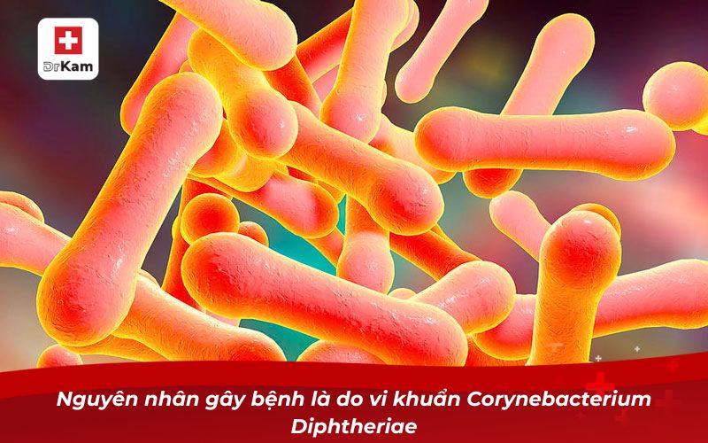 Hướng dẫn phân biệt bạch hầu và viêm họng 10 Nguyên nhân gây bệnh là do vi khuẩn Corynebacterium diphtheriae