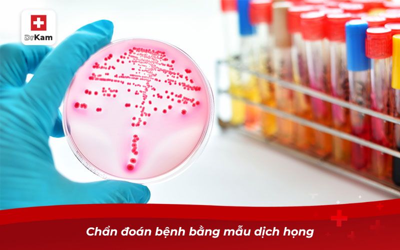 Hướng dẫn phân biệt bạch hầu và viêm họng 11 Chẩn đoán bệnh bằng mẫu dịch họng