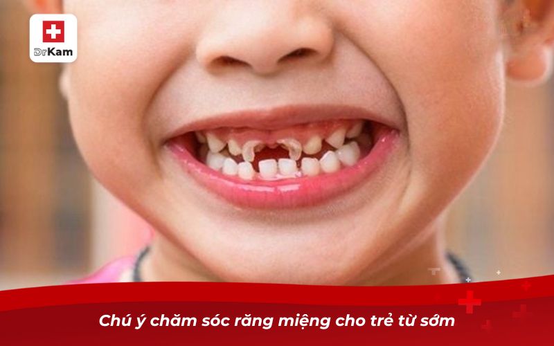 Sâu răng sữa ở trẻ em và những điều cần biết 9 Chú ý chăm sóc răng miệng cho trẻ từ sớm