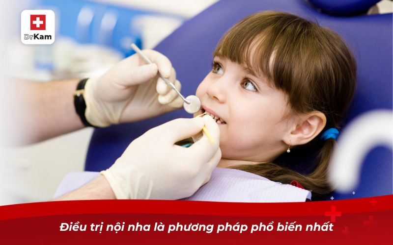 Trẻ bị sâu răng ăn vào tủy có nguy hiểm không? 10 Điều trị nội nha là phương pháp phổ biến nhất