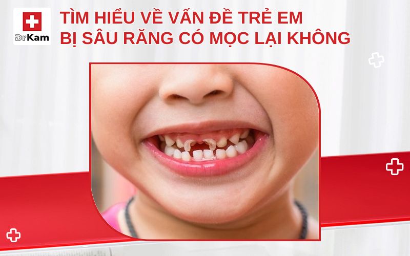 tre em bi sau rang co moc lai khong thumbnail