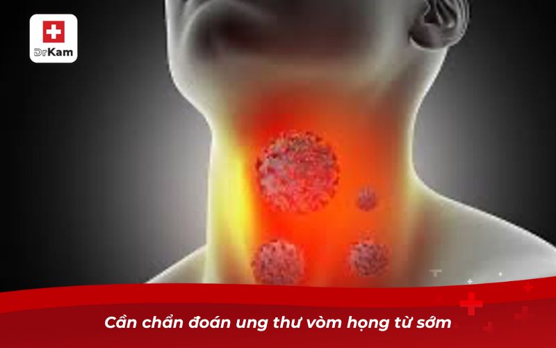 Ung thư vòm họng: Nguyên nhân, triệu chứng và cách phòng ngừa 13 Cần chẩn đoán ung thư vòm họng từ sớm