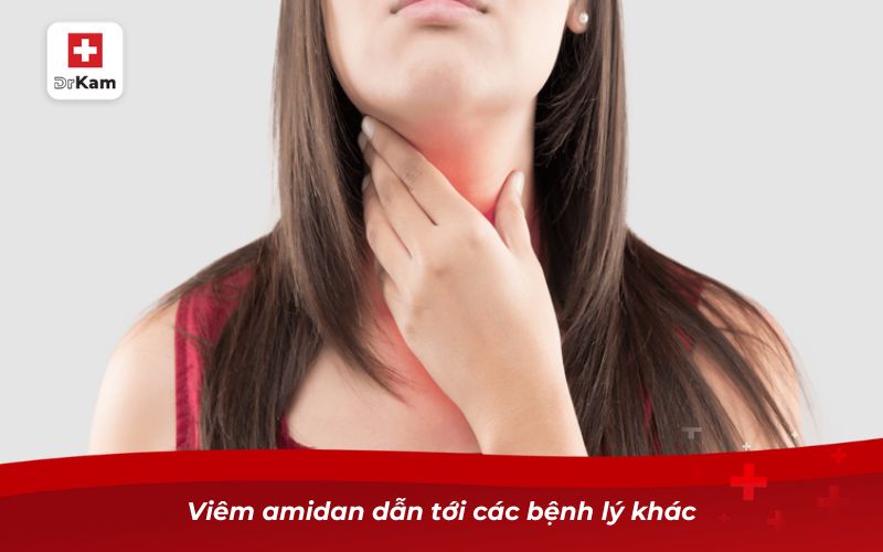 Bệnh viêm amidan có nguy hiểm không? 8 Viêm amidan dẫn tới các bệnh lý khác