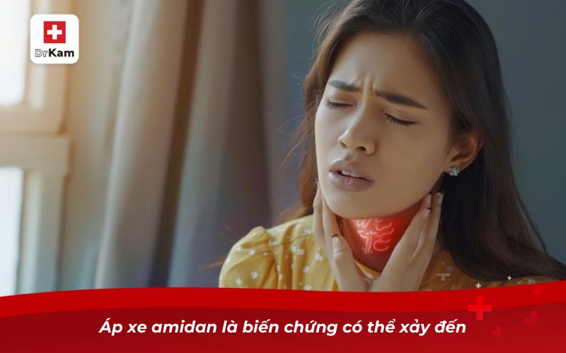 Viêm amidan hốc mủ 1 bên và những điều cần biết 10 Áp xe amidan là biến chứng có thể xảy đến