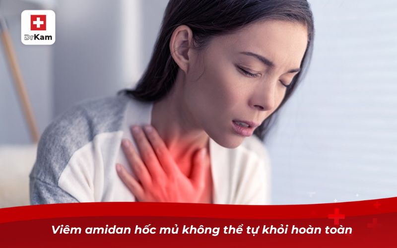 Viêm amidan hốc mủ bao lâu thì khỏi hoàn toàn? 7 Viêm amidan hốc mủ không thể tự khỏi hoàn toàn